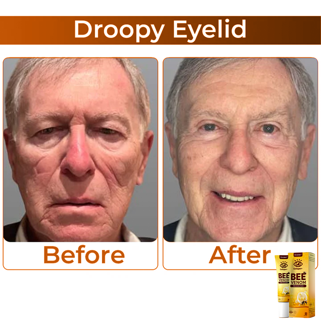 蜂の毒+コラーゲン : あなたの目元を目覚めさせる