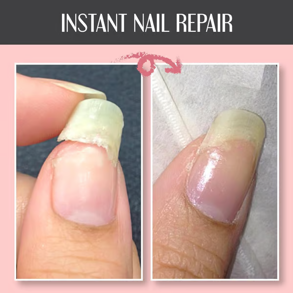 Gel Riparatore e Protettivo per Unghie: Rinforza e Rigenera 